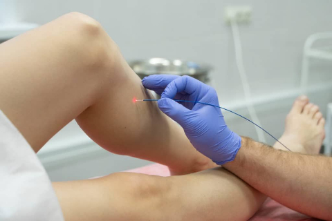 Лазерное лечение &mdash; это выгодное вложение в своё здоровье и качество жизни!